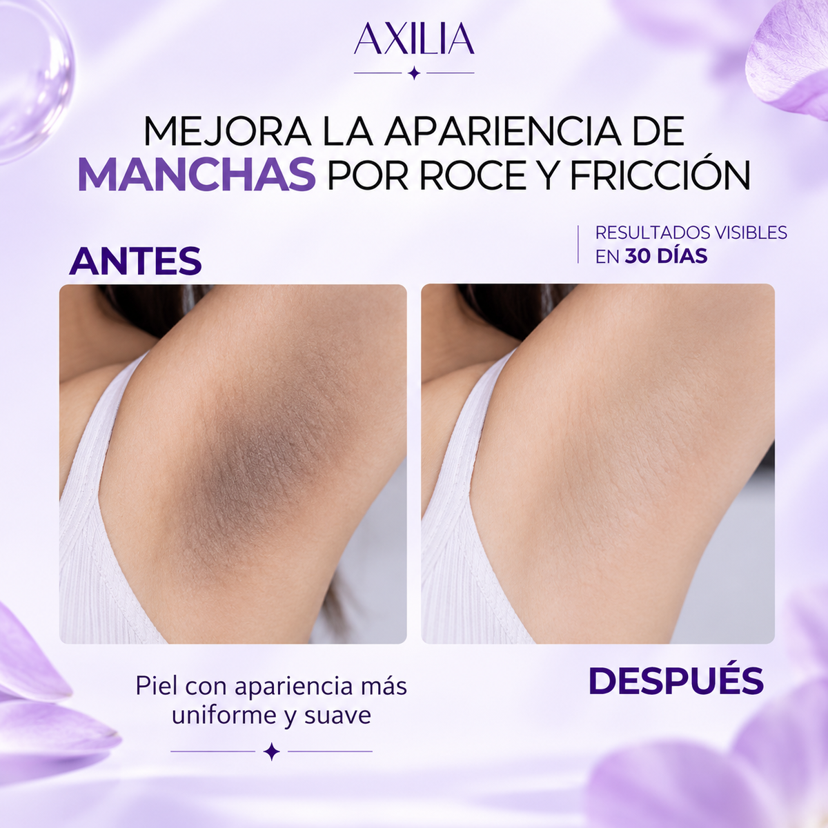 Axilia
